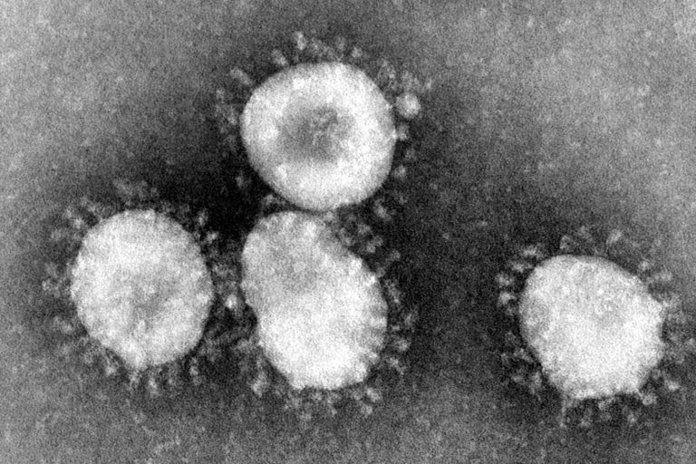 Coronavirus Spreads Globally, Rattling Markets and Economies Worldwide Suddenly